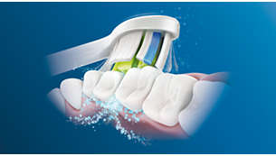Phillips ProtectiveClean 5100 tooth sonic technology