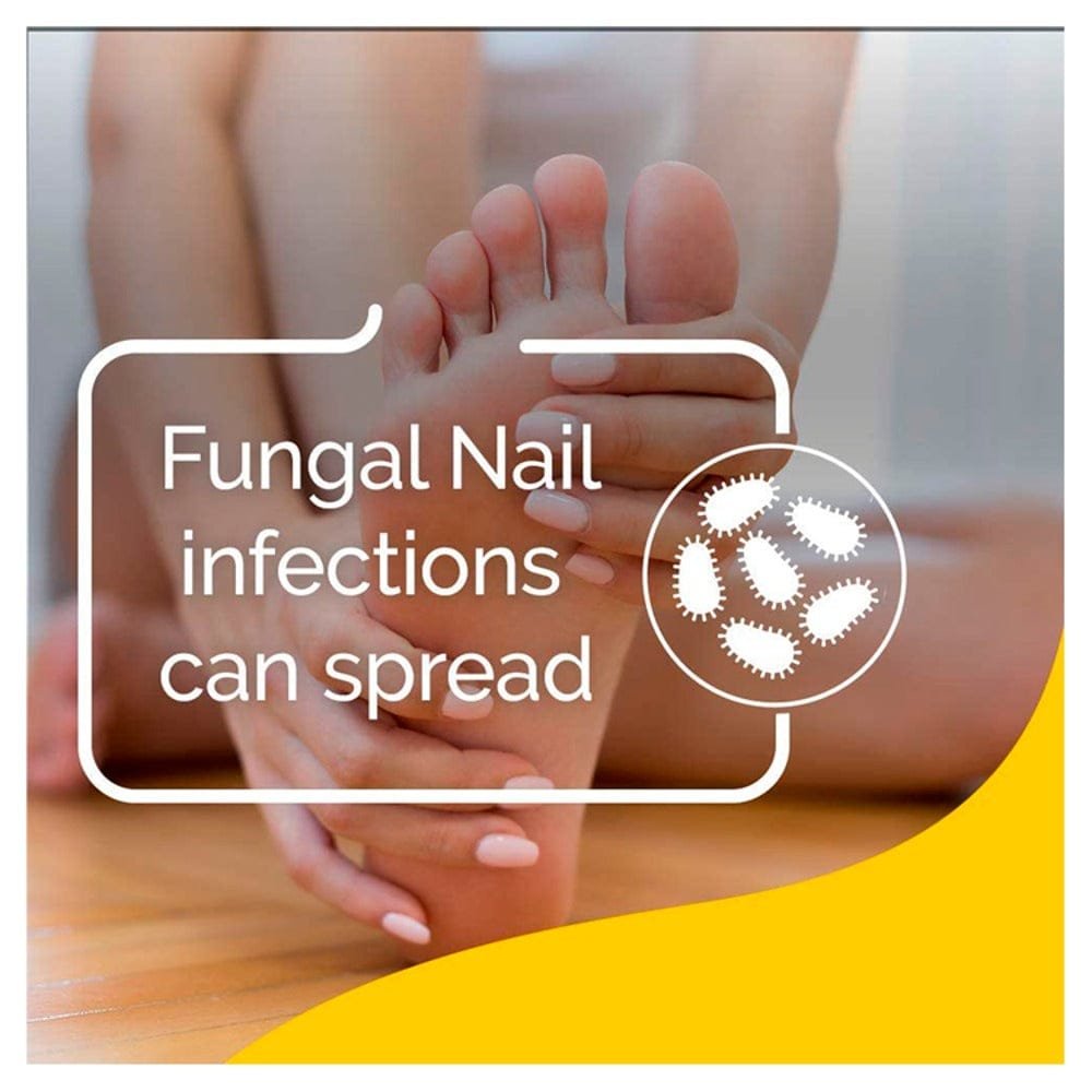 Schollmed fungal nail complete treatment kit 7 Schollmed fungal nail complete treatment kit