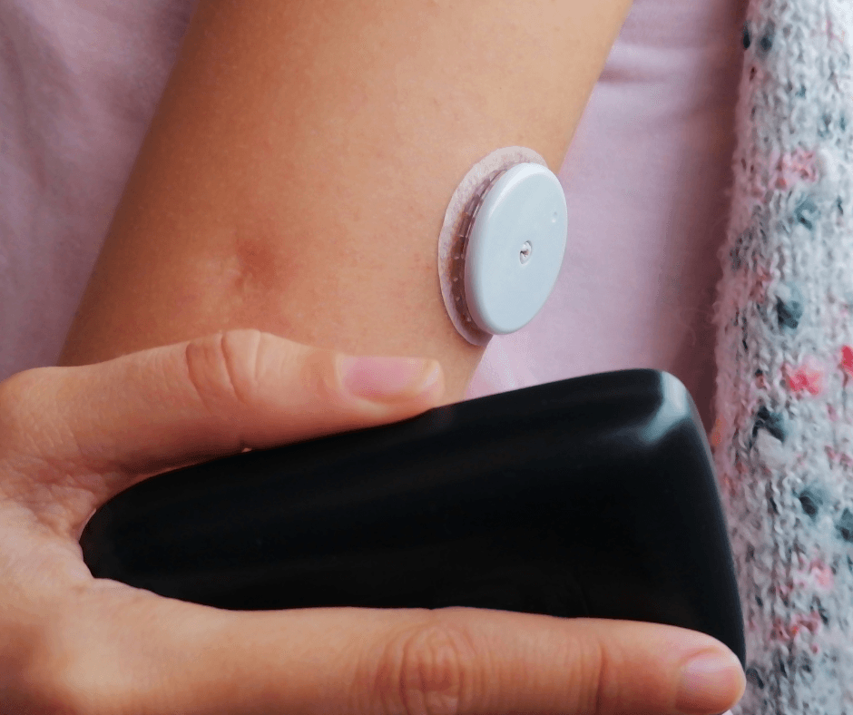 Freestyle Libre Sensor on arm
